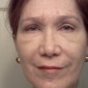 After, Day 15