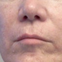 Lips before