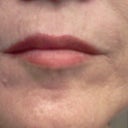 Lips after