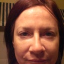 10/26/12  Granted, lighting is a little different in this pick. But i did this so you could see the difference between lower lids.  Much more noticable in this lighting.