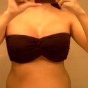 post-op day 8 : i never looked this good in this bandeau!