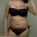 post-op day 8