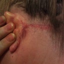 Ear after