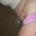 Me bending over-3 weeks after tummy tuck