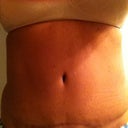 lighting is awful!  still healing!