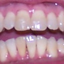 11-21-2012 Tray 19/24