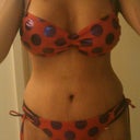 4 weeks post op mommy makeover