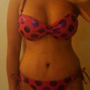5 weeks postop mommy makeover, lower abdomen still quite abit swollen