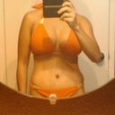 6 weeks post op mommy makeover
