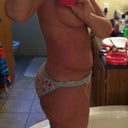 8 1/2 weeks post op
