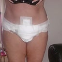 3 days post op, obviously not standing up straight