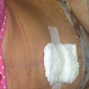 My very first glimpse of my brand new tummy...no extra skin! YAY!
