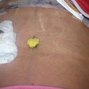 Unfortunately, I still have some stretch marks.WAY better than before though!