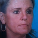 Before Age 49 ~ neck/jowels/lower&upper lids)
