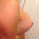 Right side
