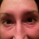Day 105 - smiling (compare to before picture)