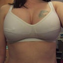 Before explant, 36DD