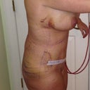 side....welll you can see how swollen I am
