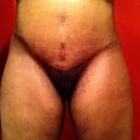 Before pic