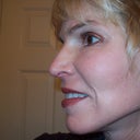 3 weeks post op. The only noticeable swelling left is under my left eye.  But it is improving with time and not very visible.