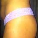 side view