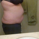 2 weeks pre-op