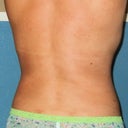 With my arms up there are no rolls. Huh, who knew!