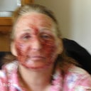 There was no way I could put makeup on my skin in after 5 days.