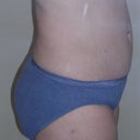 5.5 months - waist, upper and lower abs
4 months - inner/outer thighs and hips