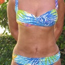 9 weeks on vacation, still a little uneven swelling