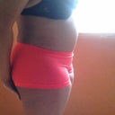 8 weeks po standing. UMMM OK REVISION PLEASE!