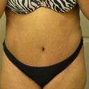6 weeks post opt! Making it do what it do baby!