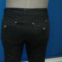 1 wk follow up at Elite Body Sculpture