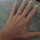 Fat hand, brought back old fat me memories :(  if this happens it's from IV or blood pressure cuff