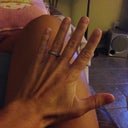 Back to normal hand! Yaaaaay!