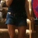 My legs, just for inspiration. This was a few weeks b4 surgery. Love being able to wear a tank top!