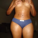 3 weeks post op.  Front Tummy.  No lipo on thighs.  I like 'em thick :)