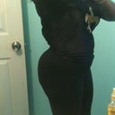 right side 6 1/2 months post op