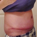 Rt Side....can't wait for swelling to go down