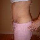 You can see the scar the binder made me