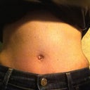 After Same jeans 5 weeks p.o.