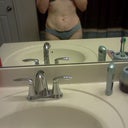 Pre Surgery