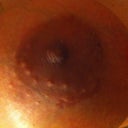 you can barely see the scar at all