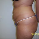 side view