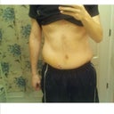 Woke up April 8th with a small lump on the right side. Within 45 minutes, my lower abdomen was about to pop. Got in contact with my surgeon and went straight to the hospital. A massive Hematoma had formed from what they believe was a blood vessel that ruptured, either from scar tissue or a suture that gave and nicked it. I was fitted with a small drain directly into my abdomen and had to slowly drain out fluid until mid May when the drain eventually fell out on its own after a shower one day.

Most of the Hematoma clotted up and drained out with the help of heat and massage over the weeks, but it was incredibly scary and uncomfortable. It felt as my stomach was going to split open at any moment. Thankfully, my surgeon concluded it would be best to wait it out and let nature take its course; original option was to go in and completely clean out the area and basically "redo" the entire operation.