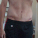 July 2012

Most of the swelling from the Hematoma is gone. There is a lot of scar tissue where that lump is, so the skin hasn't tightened back up. Most of the other swelling above the belly button has gone down, and my abdomen is starting to gain some definition. I returned back to work full time and the gym in June after being cleared by my surgeon. No pain or complaints thus far (furniture mover...so I am pretty active). The healing is coming along nicely, and so far the results are better than I ever expected. Looking forward to more successful healing (and more abs!)