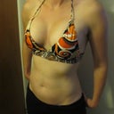 1 day post-op!