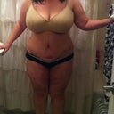 4 days postop - ready for shower, drains removed, binder off