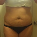 It makes me feel so strange to have this up for people to see. OBVIOUSLY Pre-Op. YUCK!!!