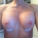 Day 10, still high but dropping slowly. The girls are starting to feel softer. Waiting for them to drop!!!